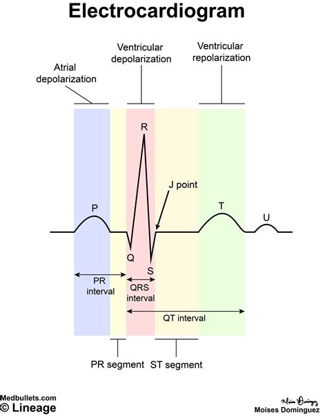 ventricular repolarization on ecg.